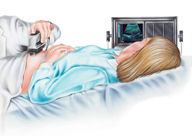 Amniyosentez nedir? image