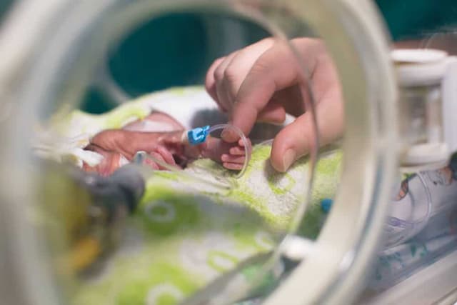 Prematüre Bebekler Hakkında Bilmeniz Gereken 7 Şey! image