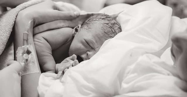 Epidural Doğum Nedir? Nasıl Yapılır? image