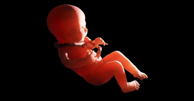 Bebeğin Boynuna Kordon Dolanması Ne Demektir? image