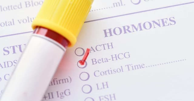 Beta HCG Nedir? Hafta Hafta Gebelikte HCG Değerleri ve Yorumları image
