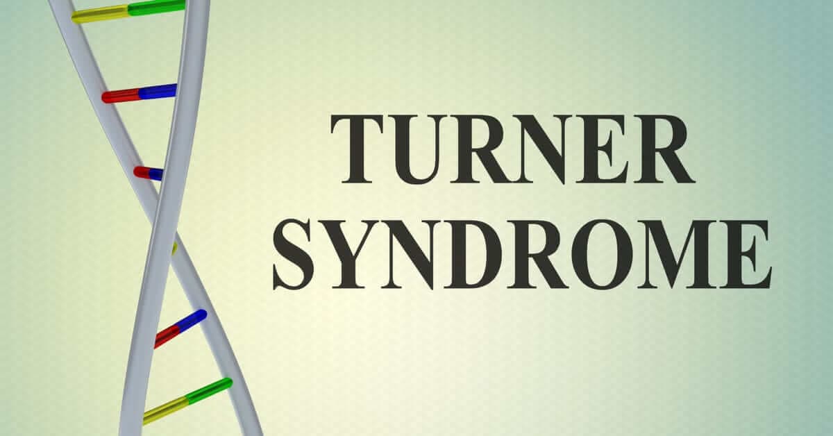 Turner Sendromu Nedir? kapak resmi