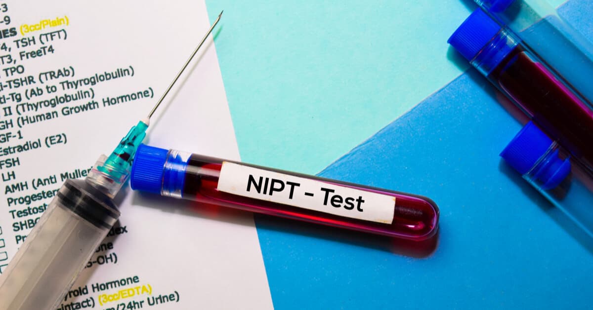nipt-testi-cesitleri